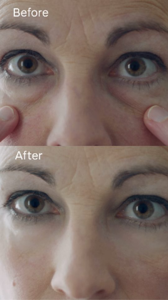 Before and after