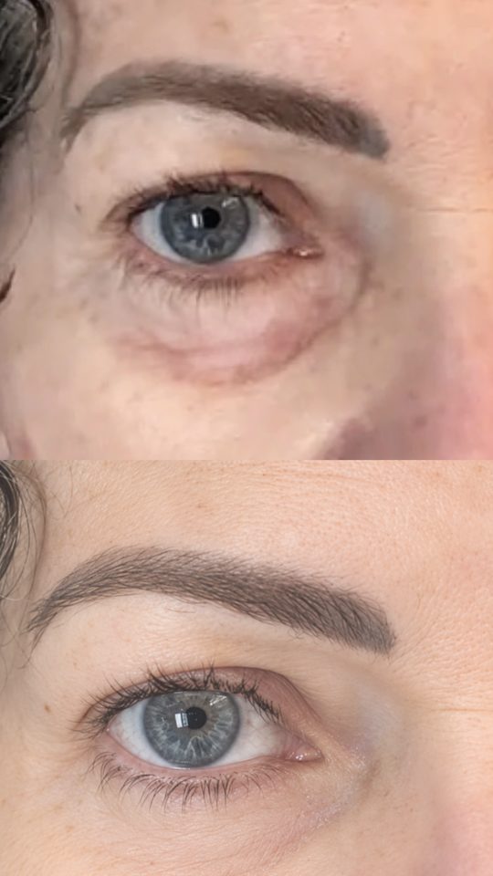 Before and after
