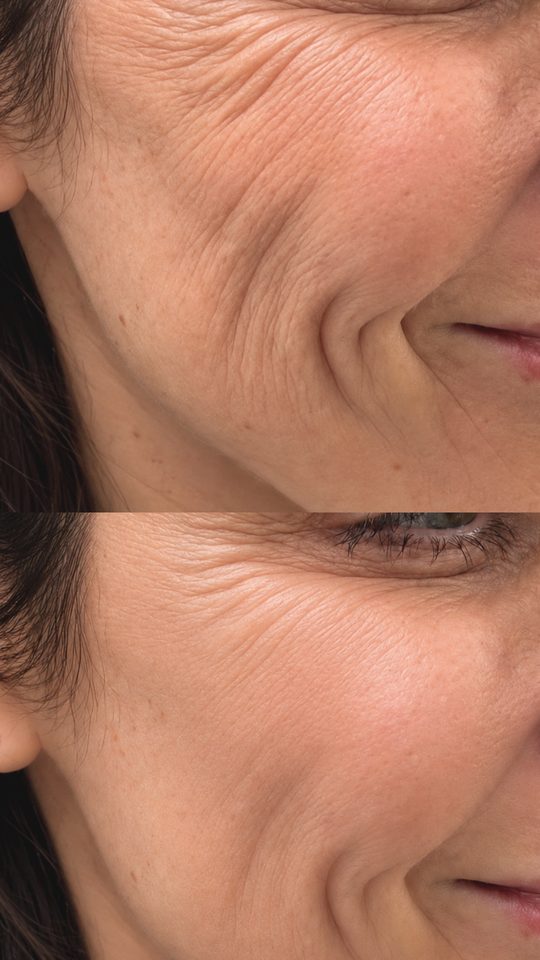 Before and after